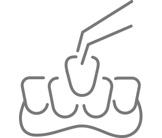 セラミック治療